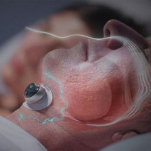 Load image into Gallery viewer, Anti-Snoring Muscle Stimulator