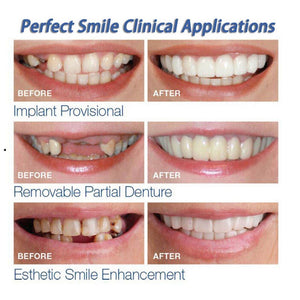 Instant Perfect Smile Upper & Lower Clip/Snap On Veneers for Perfect Teeth