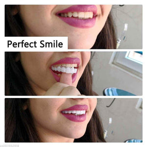 Instant Perfect Smile Upper & Lower Clip/Snap On Veneers for Perfect Teeth